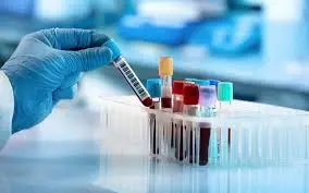 our drivers our certified to handle and deliver blood samples